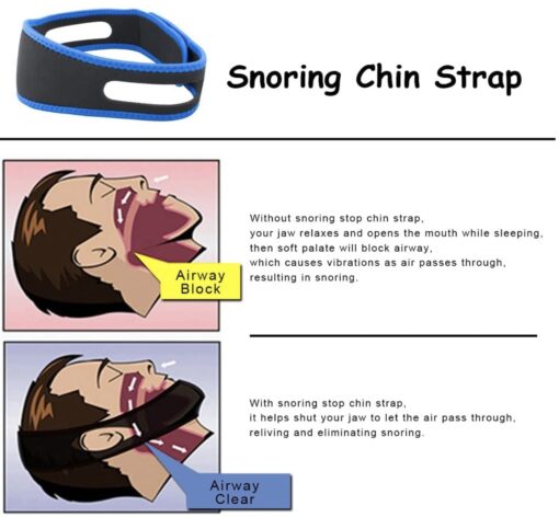 Anti Snoring Chin Strap