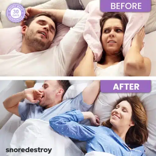 QuietNights Tongue Retainer 2
